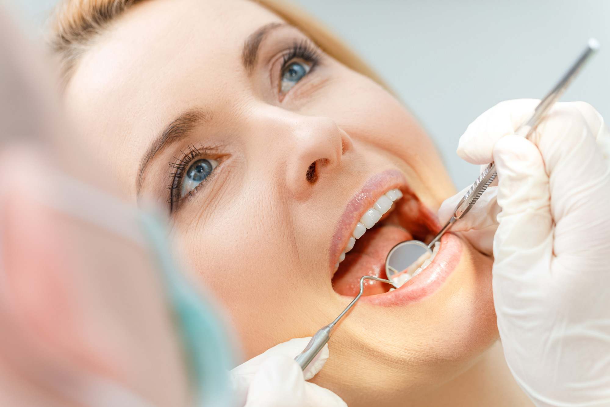 Perfect Pearly Whites: How Often Should You Schedule a Dental Check Up?