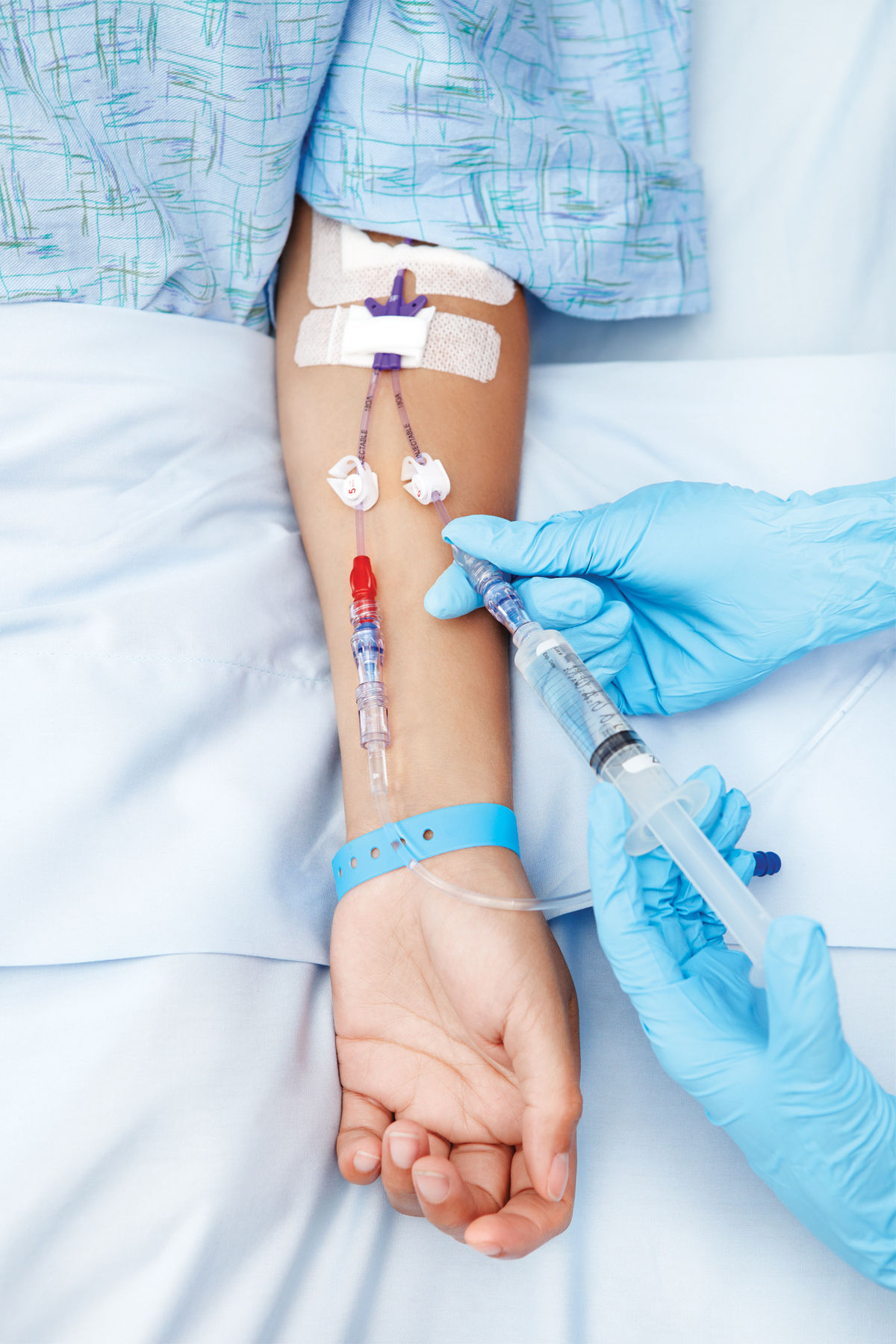 Common Types of IV Infusion Therapy