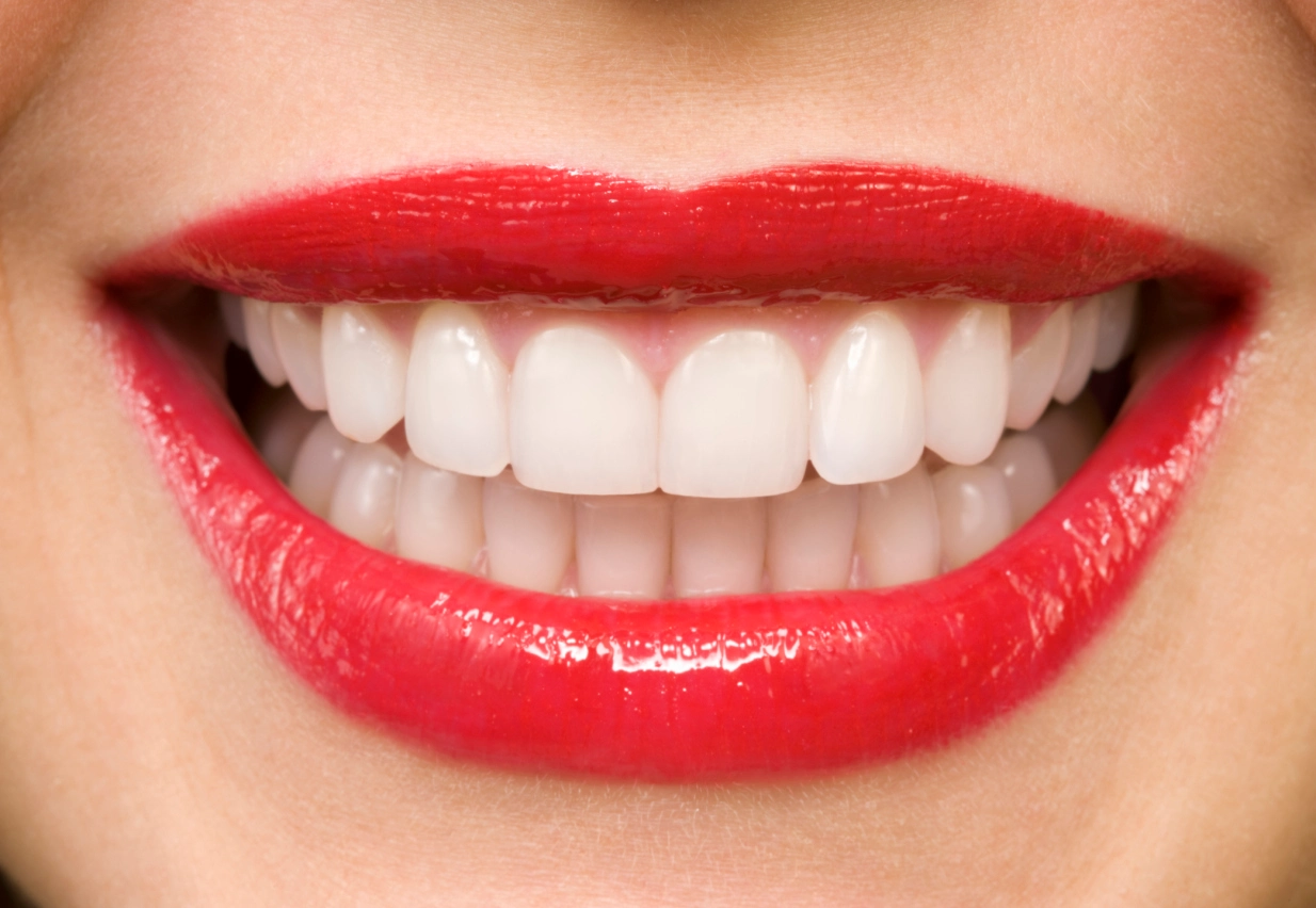 All You Need to Know About Teeth Whitening