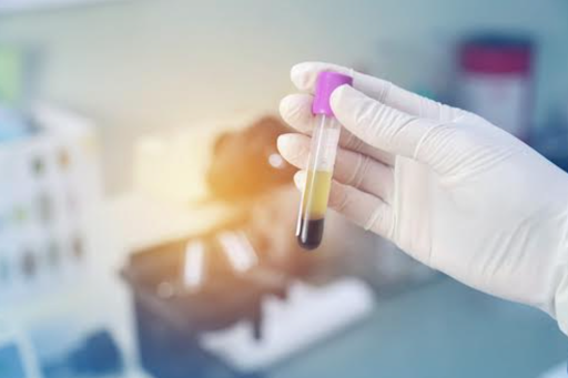 What Is the Recovery Time After a PRP Injection?