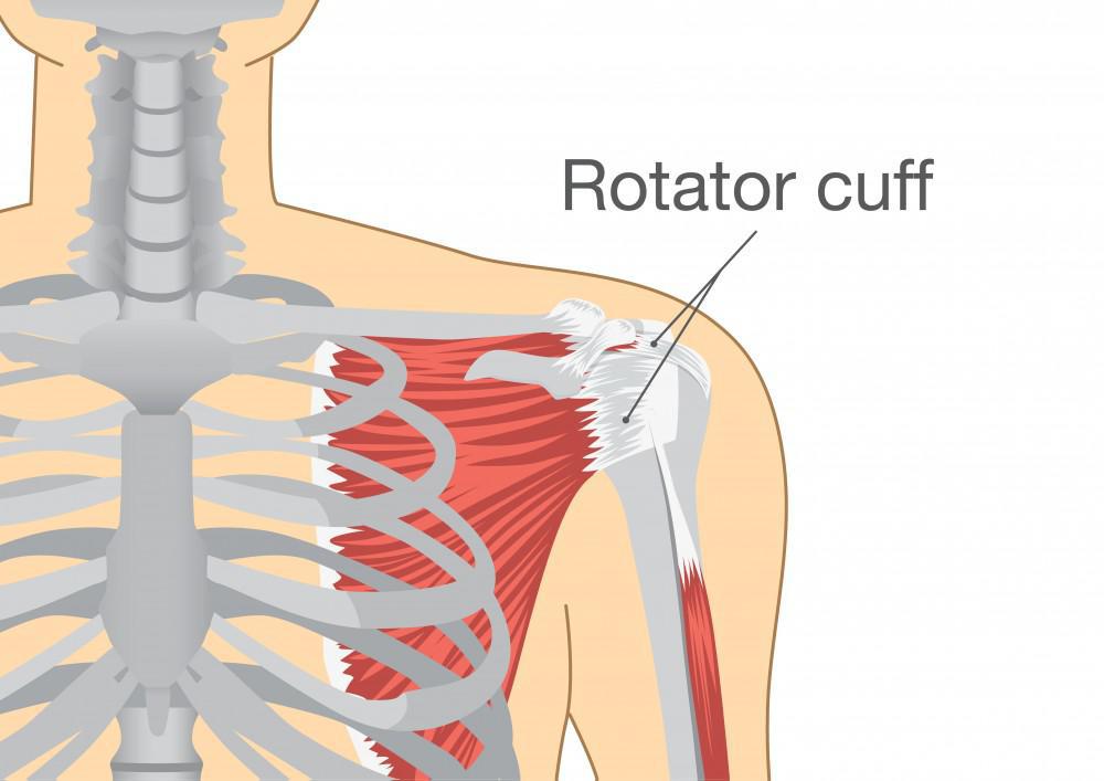 Understanding the Causes that Usually Increase the Risk of Suffering Rotator Cuff Tears