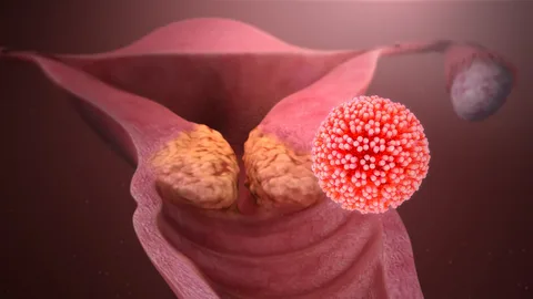 What You Didn’t Know About HPV