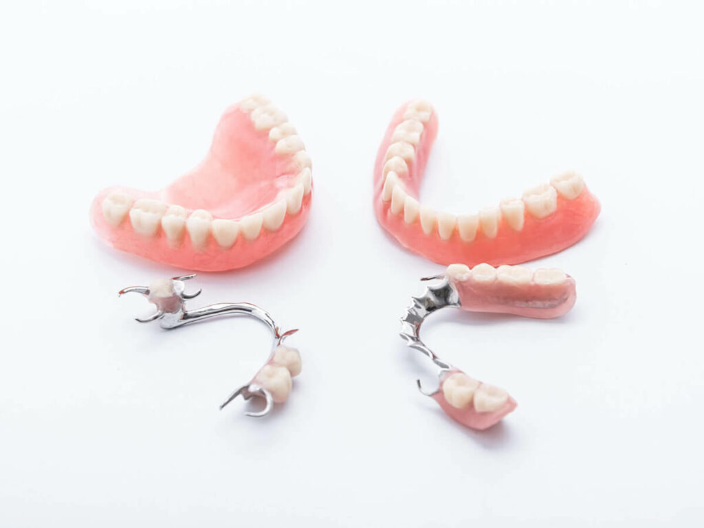 5 Convincing Reasons to Ditch the Dentures for All-on-4 Implants