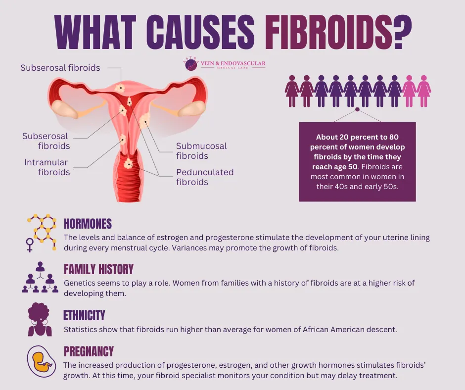 What are the most common causes of fibroids?