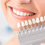 Understanding Cosmetic Dentistry Services in San Ramon