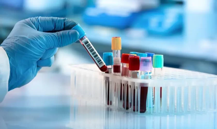 All You Need to Know About Blood Testing