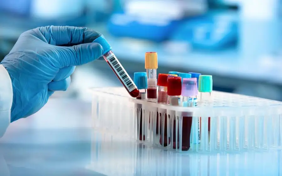 All You Need to Know About Blood Testing